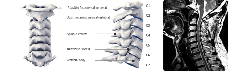 7개의 등골뼈로 된 척추의 맨 윗부분 
